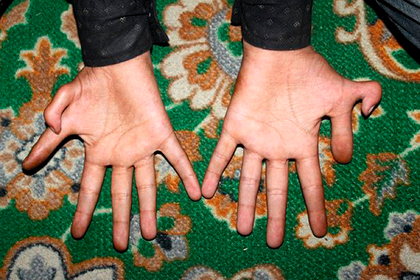 Мальчик с шестью пальцами на каждой руке похвастался успехами в играх и крикете: Люди: Из жизни: Lenta.ru #Жизнь #Новости #Сегодня