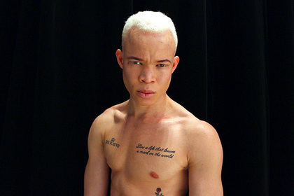 Спасенный от колдунов альбинос из Африки стал моделью #Жизнь #Новости #Сегодня
