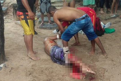 Бразилец лишился ноги после нападения акулы #Жизнь #Новости #Сегодня