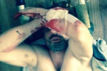 Мужчина ослеп после пыток в полиции и разочаровался в российском правосудии #Россия #Новости #Сегодня