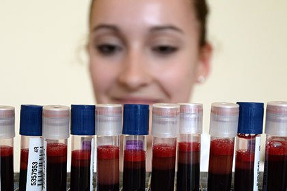 Биологический возраст человека научились вычислять по анализу крови
