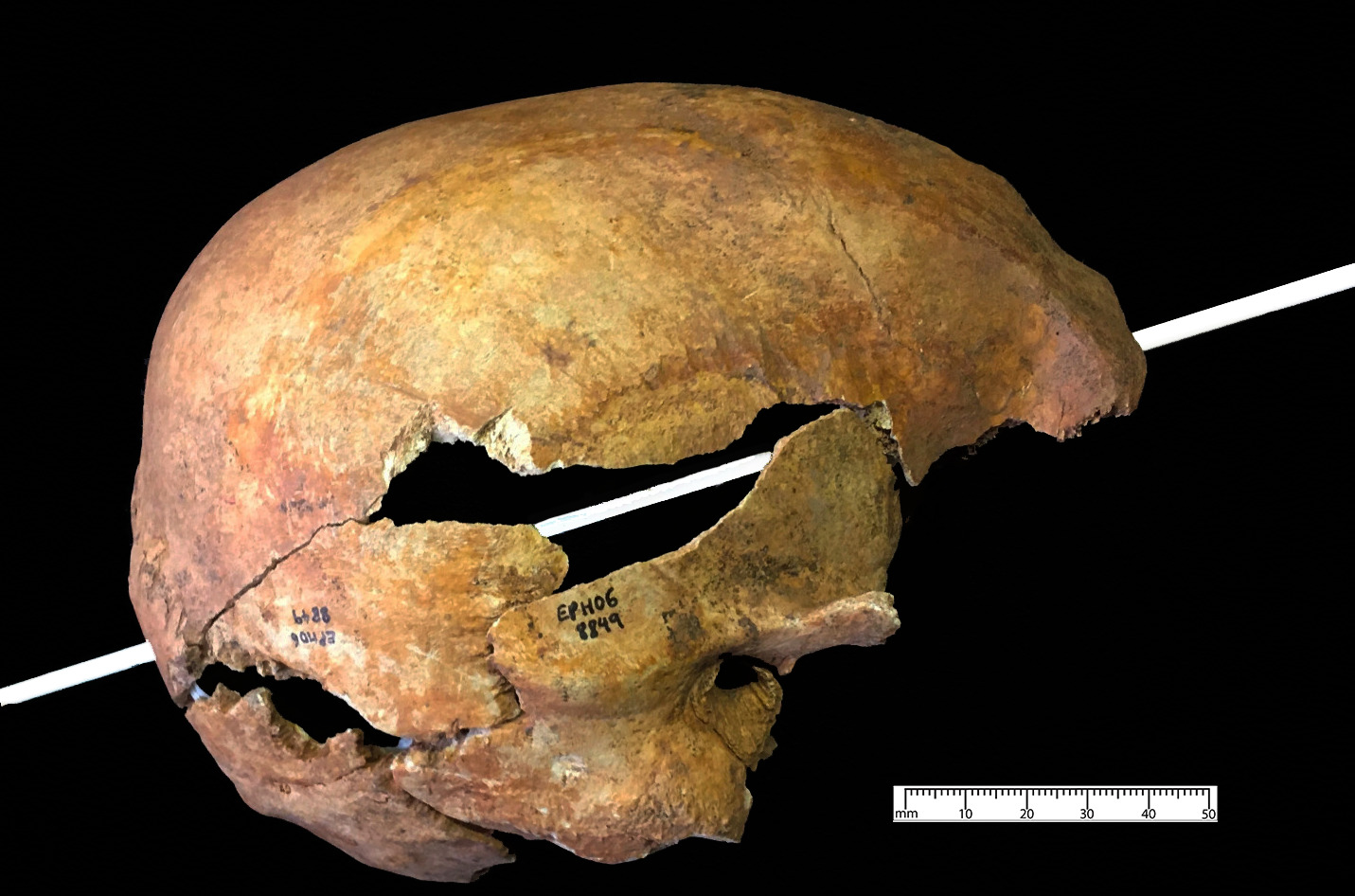 Рана черепа показывает, насколько смертельными могут быть средневековые стрелы